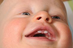 Проблемы с зубами у детей 1