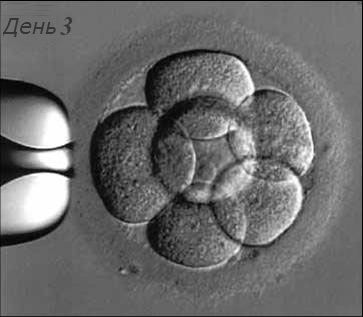 двойной перенос эмбрионов